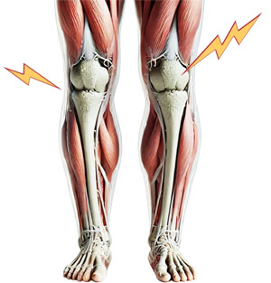 horizontal impact on knee joint